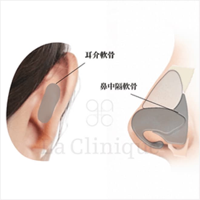 鼻先の手術