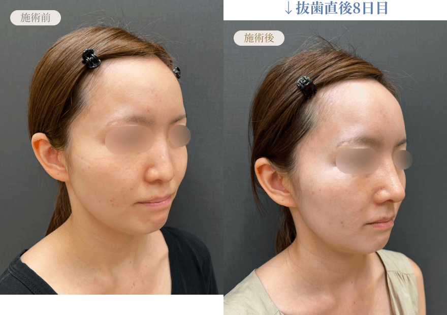 圧倒的に軽い・短いダウンタイム