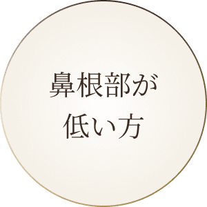 鼻根部が低い方