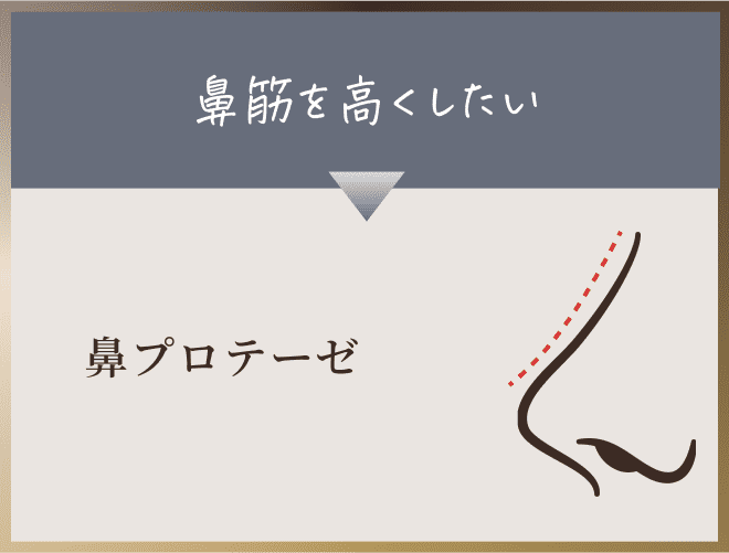 鼻プロテーゼ
