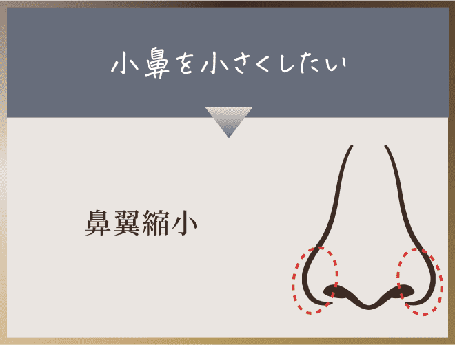 鼻翼縮小
